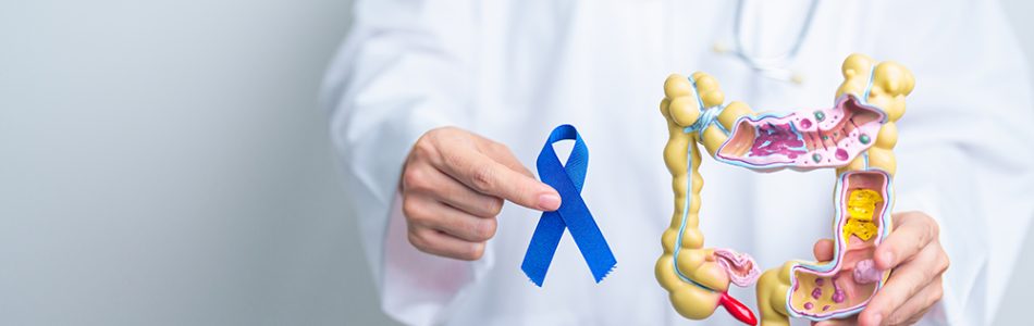 Doctor holding Blue ribbon with human Colon anatomy model. March Colorectal Cancer Awareness month, Colonic disease, Large Intestine, Ulcerative colitis, Digestive system and Health concept